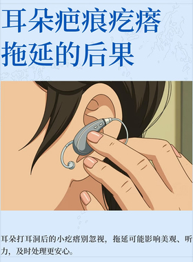 【磁吸耳夹防增生】耳洞耳垂术后