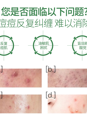 莉梵妮祛痘修护精华液2.0版正品