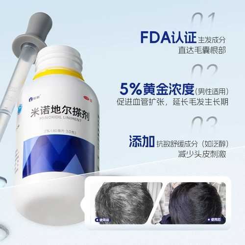 仙琚 Миноксидил линимент 5% мужское выпадение волос, выпадение волос и рост волос, искренний официальный флагманский магазин