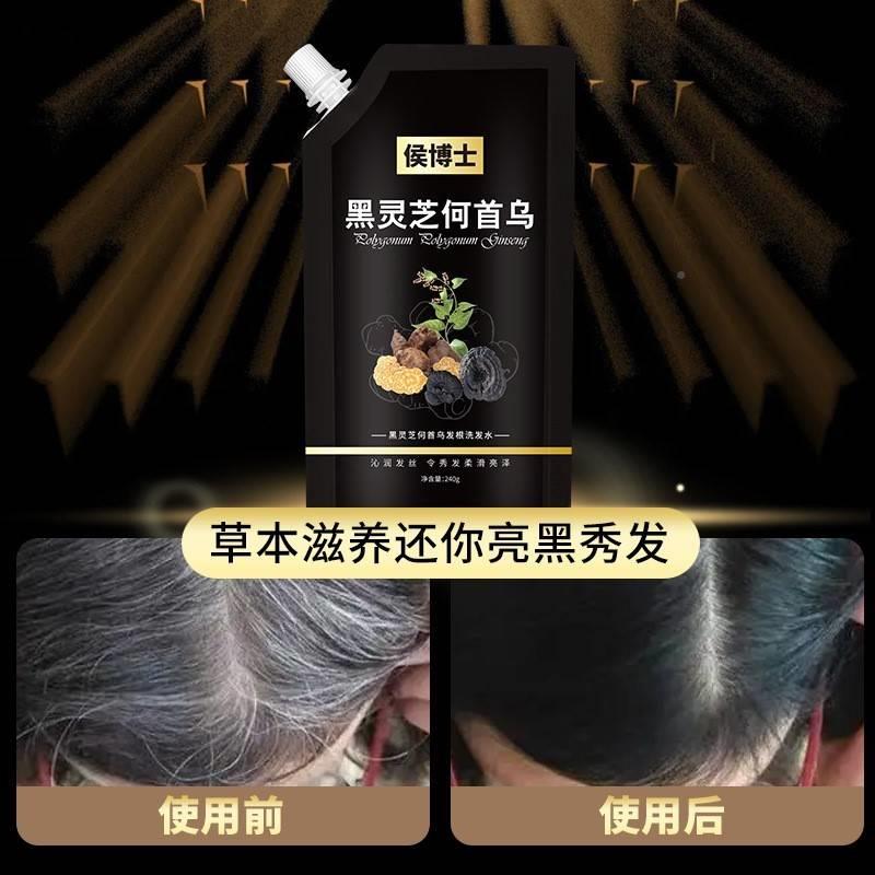 侯士黑灵芝何首发乌黑QLZ发博根洗水不染发根源发候头发自然转黑 - 图1