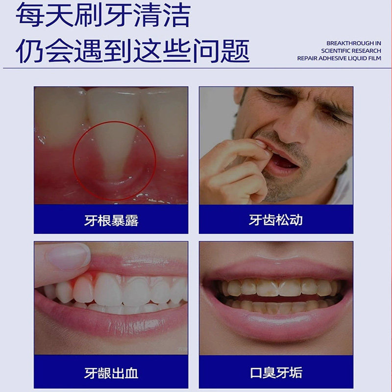 医用漱口水杀菌消炎牙周炎除口臭持久留香牙结石簌遬口水正品便携,淘宝优惠券,粉丝福利购,淘宝优惠卷