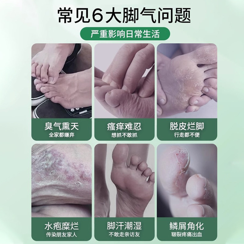 云南本草脚气喷剂除脱皮杀菌喷雾去烂脚丫止痒膏臭脚出汗脚痒水泡,淘宝优惠券,粉丝福利购,淘宝优惠卷