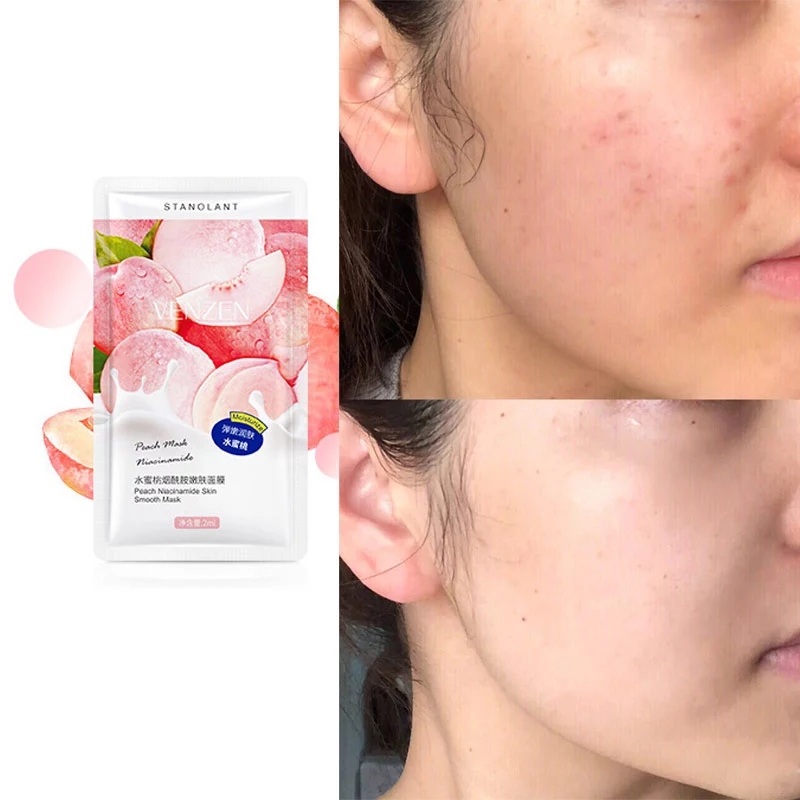 30片水蜜桃烟酰胺嫩肤面膜 30pcs Peach Niacinamide Mask face - 图2