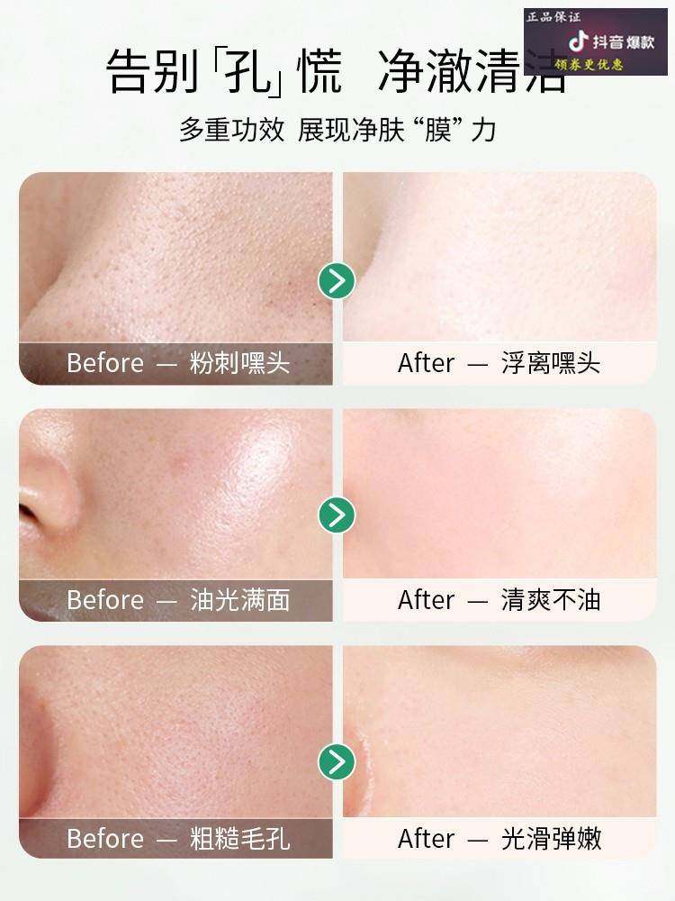 屈臣氏毛孔净化器jacopin水杨酸 DeaoMax贴片面膜