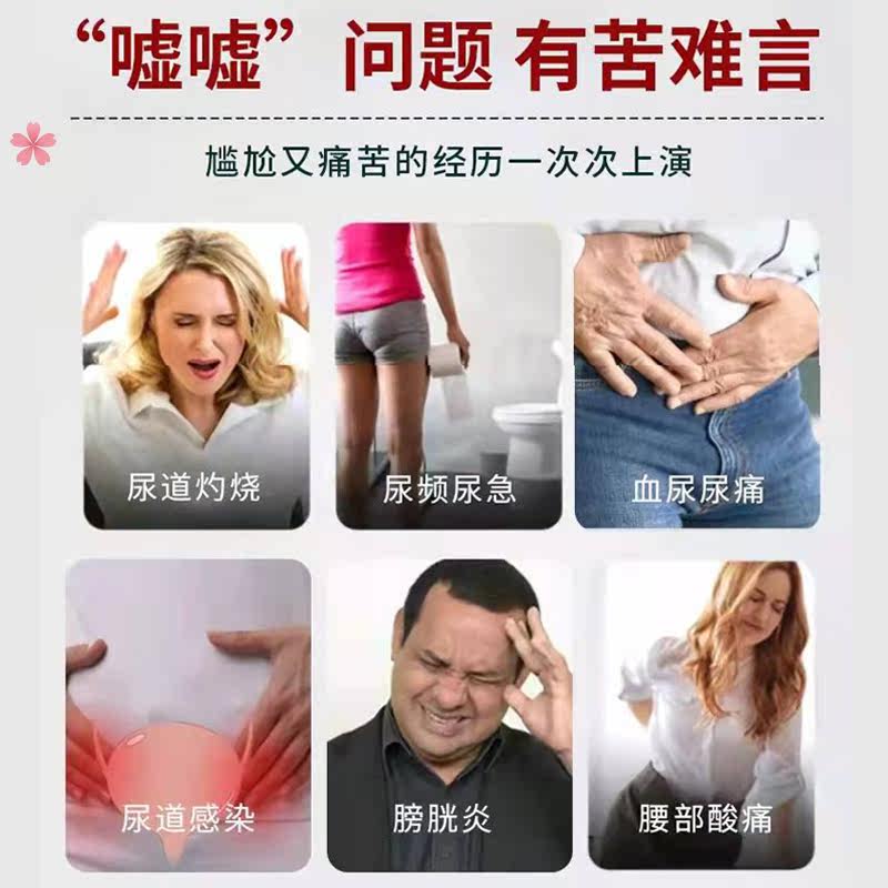 女尿道炎男前列腺增生疼痛尿急舒贴 戴蒂拉医疗器械保健理疗