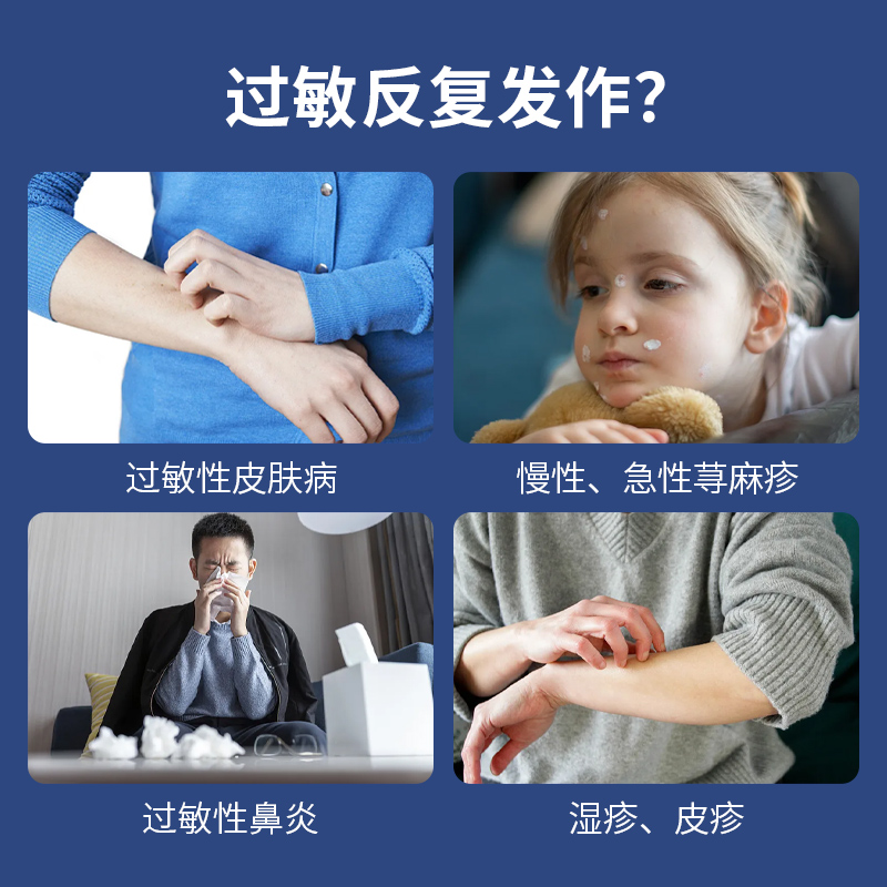 ALL缓解预防荨麻疹过敏药抗皮肤过敏性鼻炎药眼部皮肤痒日本进口