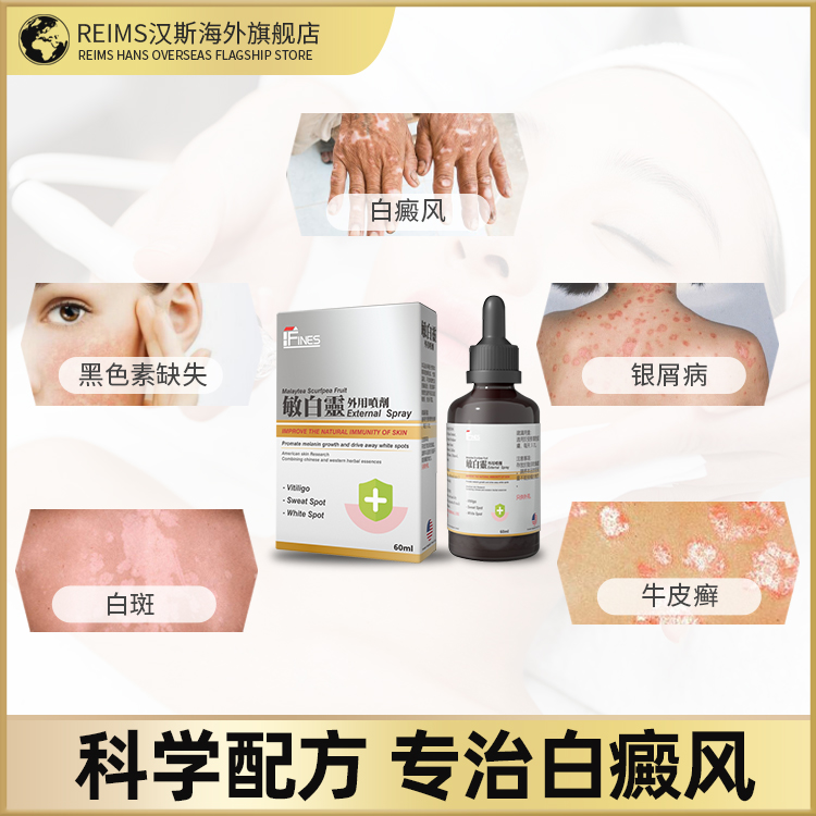 fines敏白灵外用喷雾消白斑补骨脂脂溢性皮炎寻常性白癜风外用药