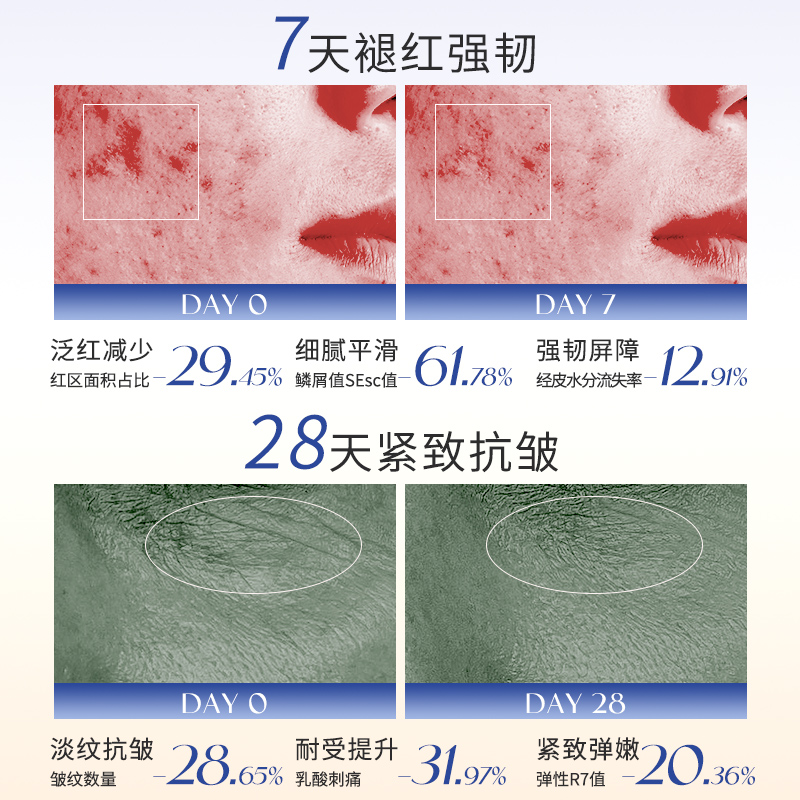 ORANOT柔酸肌底液调理焕肤提亮温和刷酸改善闭口收缩毛孔精华液01 - 图2