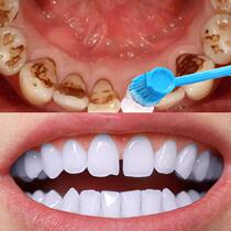 Buy 2 send 1 (teeth white more beautiful) teeth to go yellow to calculus smoke stains tea stains male and female universal tooth yellow deities