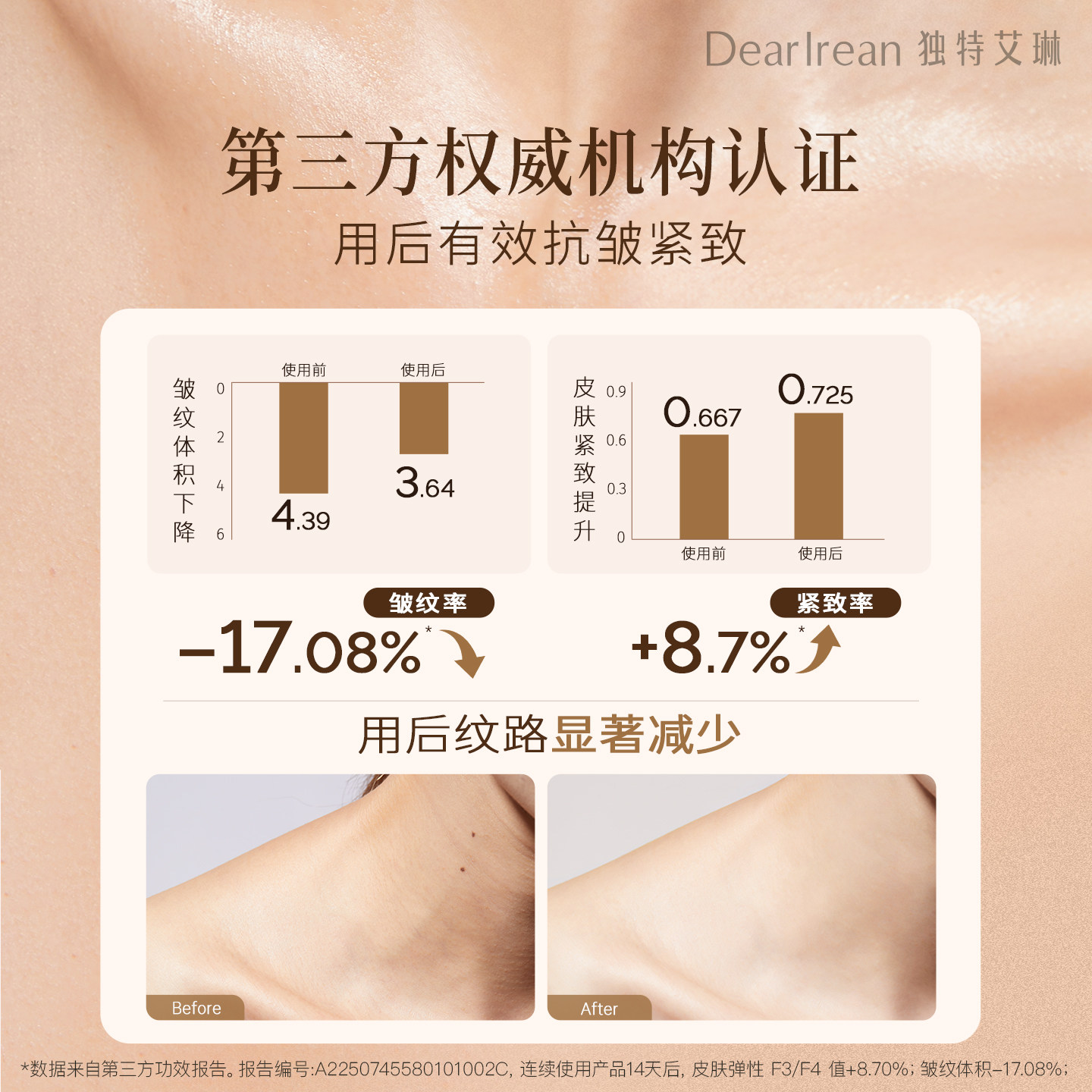 独特艾琳身体精华护肤油亲肤保湿不油腻补水留香防干燥滋润全身女