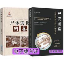 Autopsy: An electronic version of the body changes in the natural environment