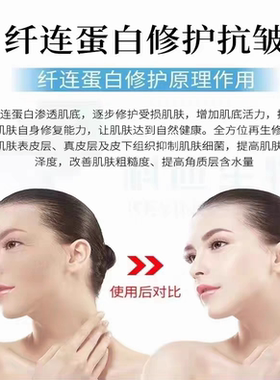 纤连蛋白淡化细纹激光点斑术后