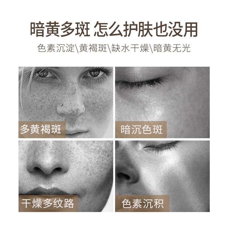 强力正品美白神器淡化色斑祛斑霜 SKCHUN乳液/面霜