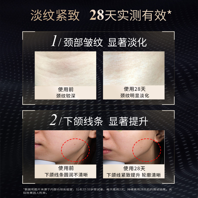 【专享】美国瑞斐时黑天鹅颈纹颈霜 瑞斐时护肤颈霜