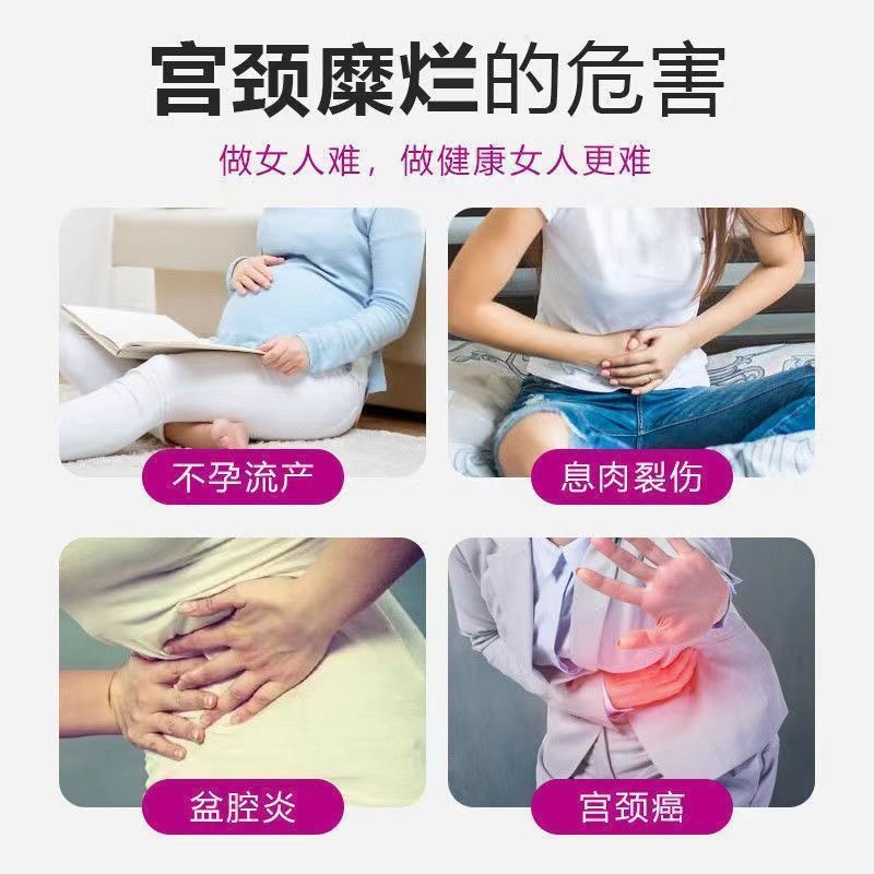 修正药业消糜栓官方旗舰店YKX妇炎洁凝胶妇炎康片阴道炎妇科用药 - 图3