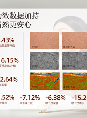 书呆子0.2%视黄醇淡纹精华乳抗皱祛痘亮肤控黑头平滑细腻肌肤A醇