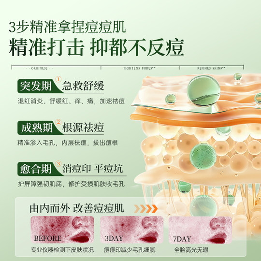 Medizinische Qualität, 3 Tage ohne Akneflecken + 5 % Centella Asiatica-Reparatur