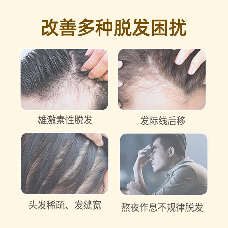  武汉惠好大药房白发脱发