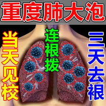 Special medicine for pulmonary alveolar foam treatment to not come to Qi and chest tightness short cough and clear pulmonary alveolar with slow-resistance pulmonary special effects traditional Chinese medicine post