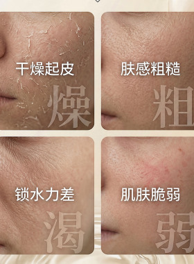 DT【特护精华】舒肌特护精华液改善干燥皮肤保湿伊华同款