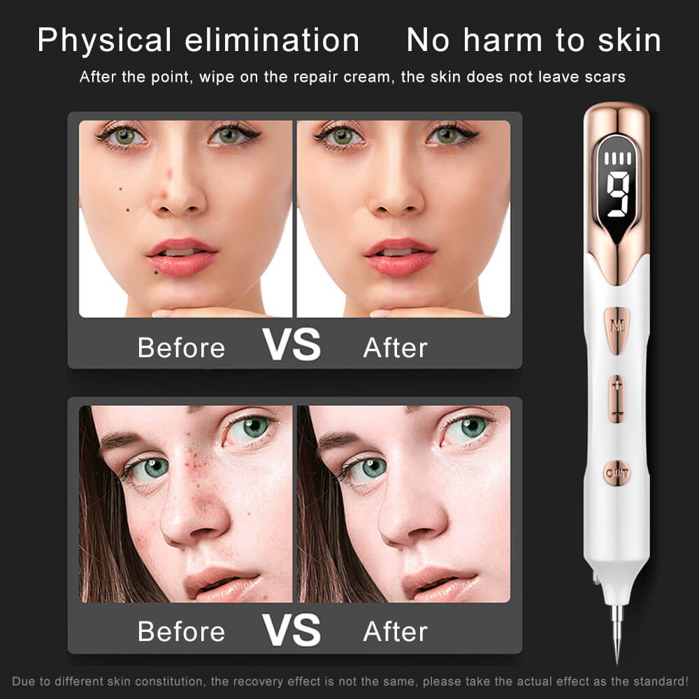 Electric Plasma Mole Removal Pen Laser Set Wart Remover Skin-图2