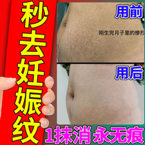 Go to gestational tattooed pregnant woman special postnatal compact belly petchen elimination to prevent repair of oil obesity growing orange peel