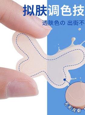 精灵耳贴耳朵支撑隐形不痛招风耳