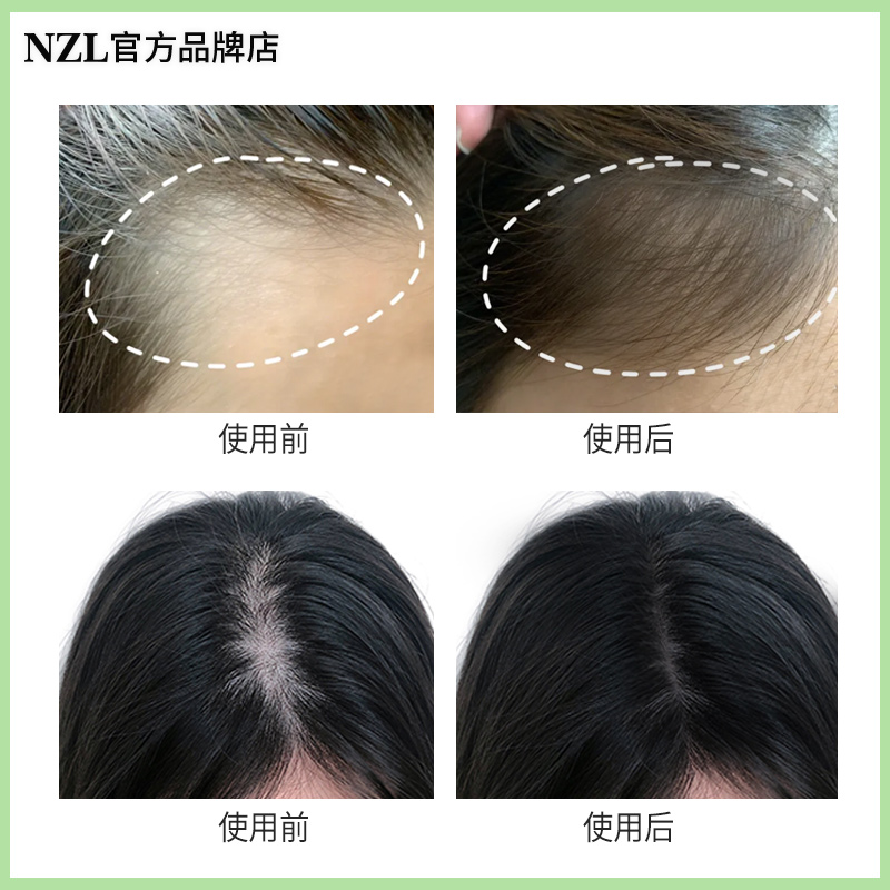 NZL尼正力洗发水防脱育发洗发水男女洗露妮呢正立正品官方旗舰店 - 图1