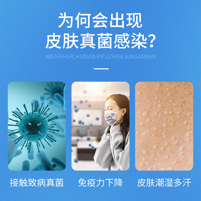 抗真菌药膏或霜剂，用于治疗真菌感染(抗真菌药软膏)