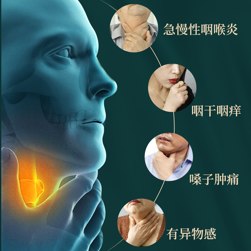 芙顺堂咽扁舒冷敷凝胶急咽炎慢性咽喉炎专冷敷治疗用李时珍中医药 - 图0