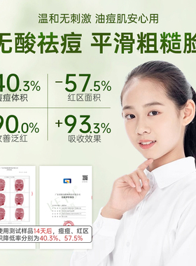 青春痘祛痘膏青少年无酸温和祛痘
