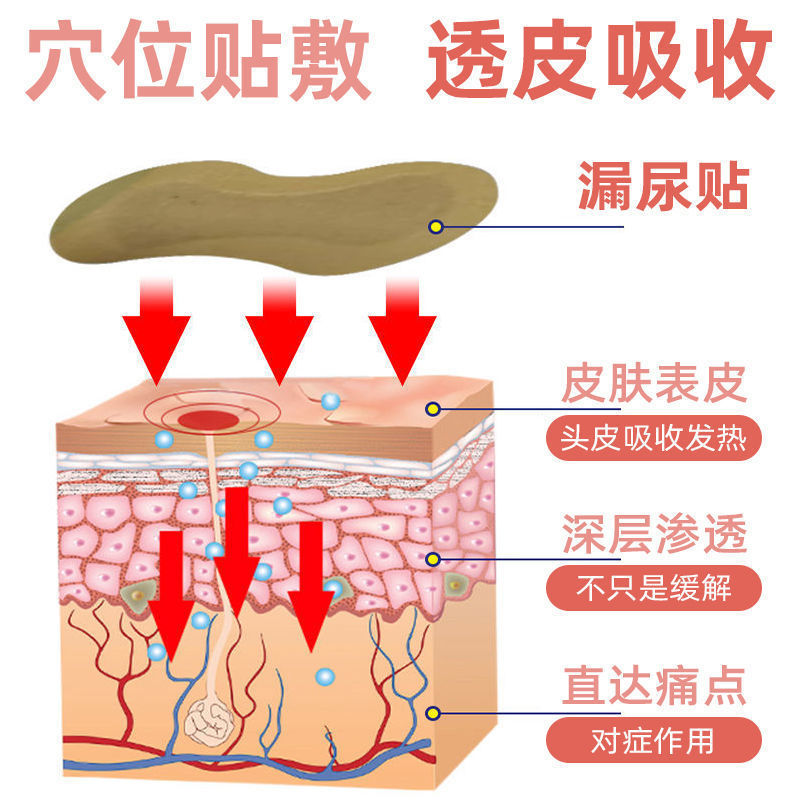 【当晚止漏】妇女漏尿产后漏尿憋不住尿频尿急中老年漏尿修复神器 - 图1