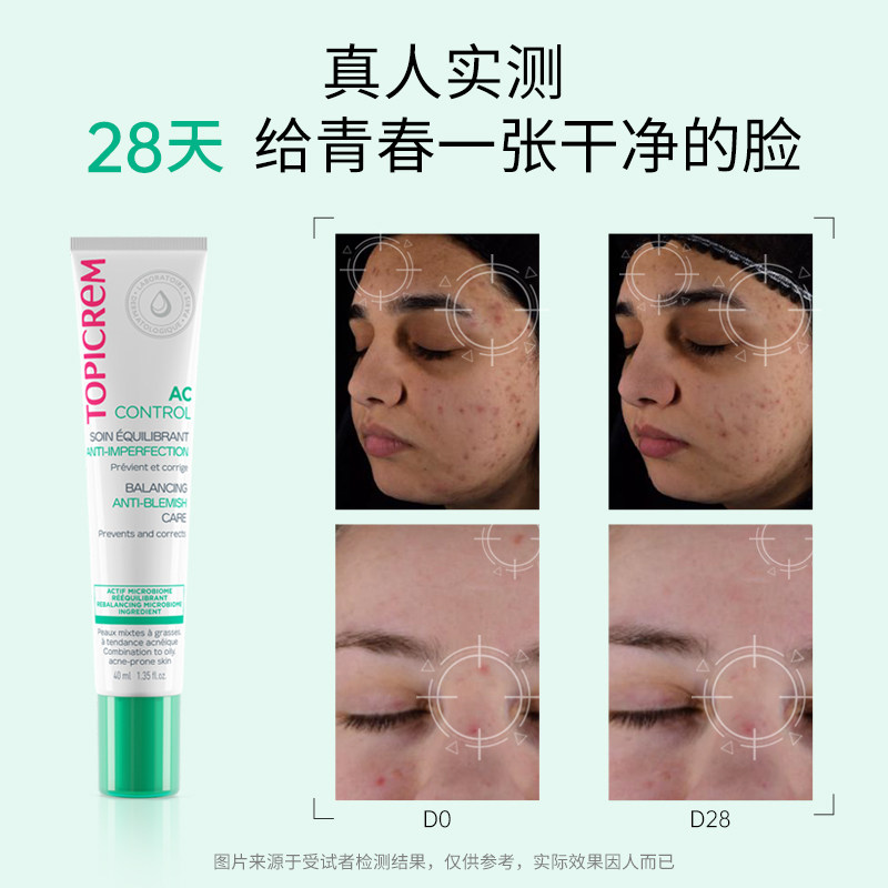 Topicrem特碧润舒缓修复面部乳液褪红强韧屏障补水轻润效期24年9