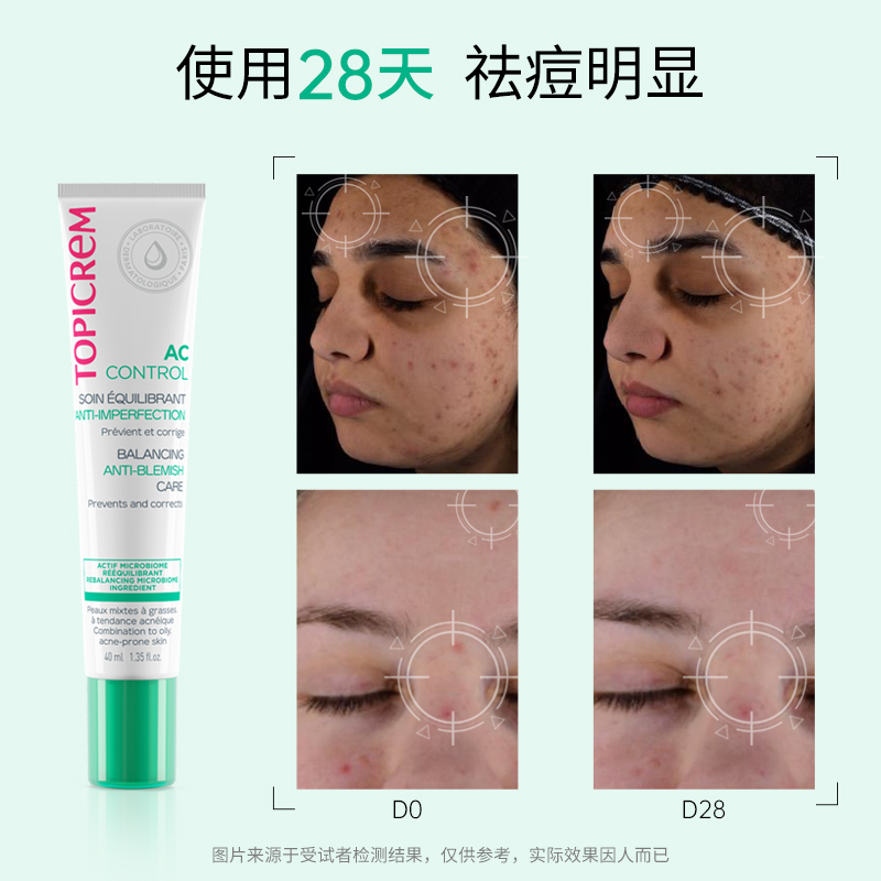 Topicrem特碧润祛痘控油平衡乳淡痘印修护屏障舒缓调理肌肤收毛孔