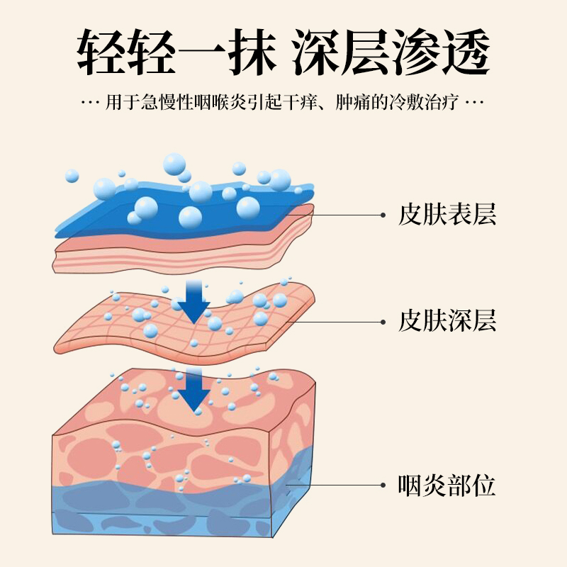 芙顺堂咽扁舒凝胶专急慢性咽喉炎用软膏冷敷治疗官方正品异物感康 - 图2