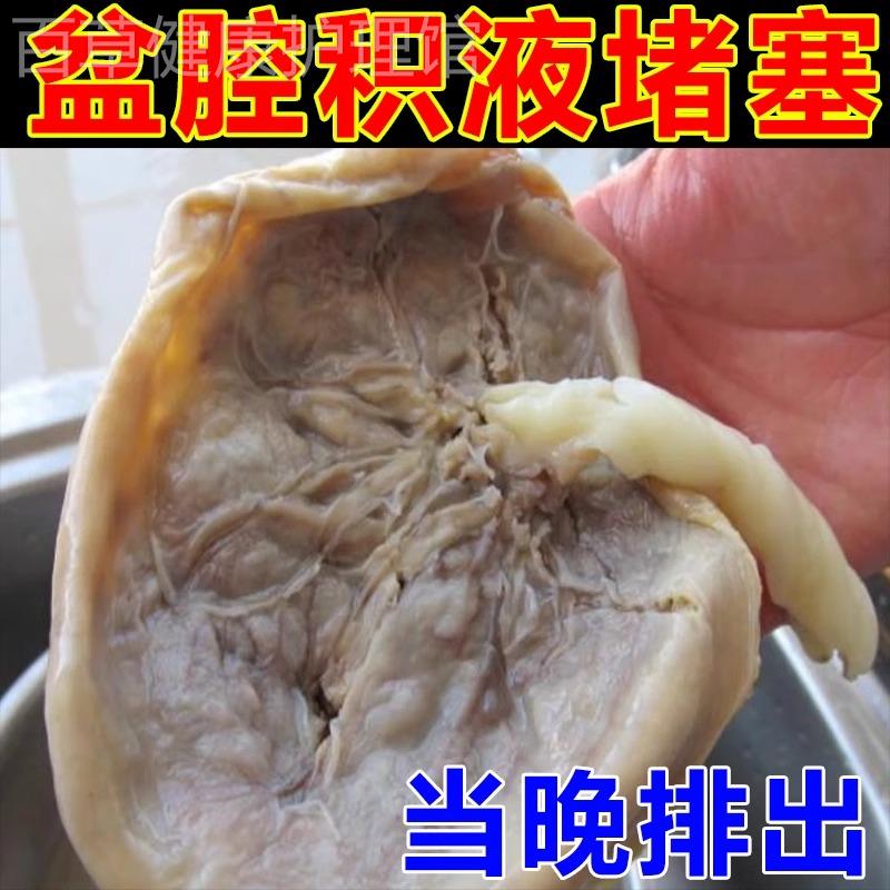 不用抽液】盆腔积液盆腔炎白带异常腰腹疼痛小腹坠痛腰痛排积液G - 图0