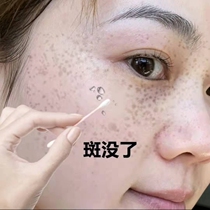 No scabs and spots to say bye-bye remove the face cut black spot spots down to blackshoot 2 Fat 3.