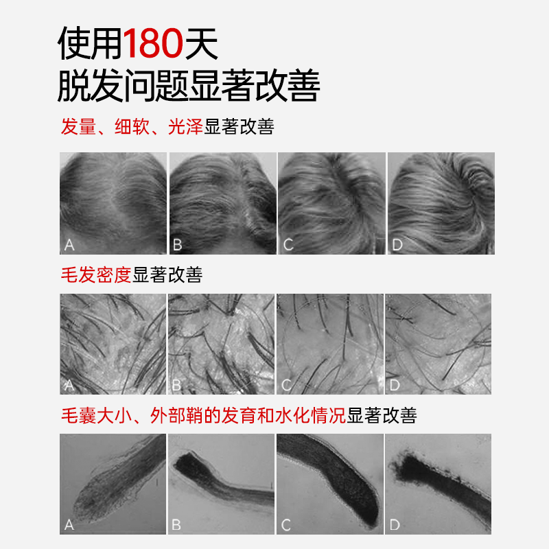 佩力丝小红丸Pilexil西班牙进口防脱锯叶棕维生素固发软安全胶囊