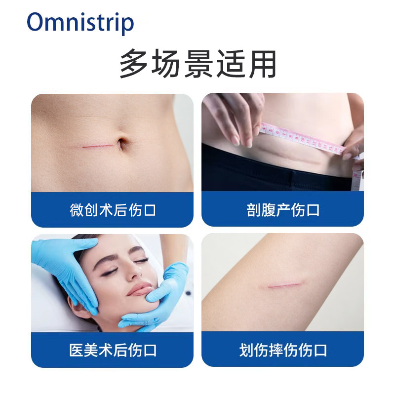 德国Omnistrip减张贴免缝胶带防止变宽增生疤痕愈合伤口免缝合器