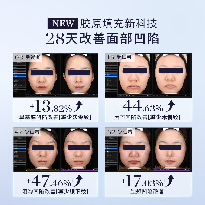 【详情领300补贴!】GEMO金茉4R胶原机超频科技胶原炮面部美容仪