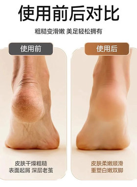 电动磨脚器2026年新款电动脚底修