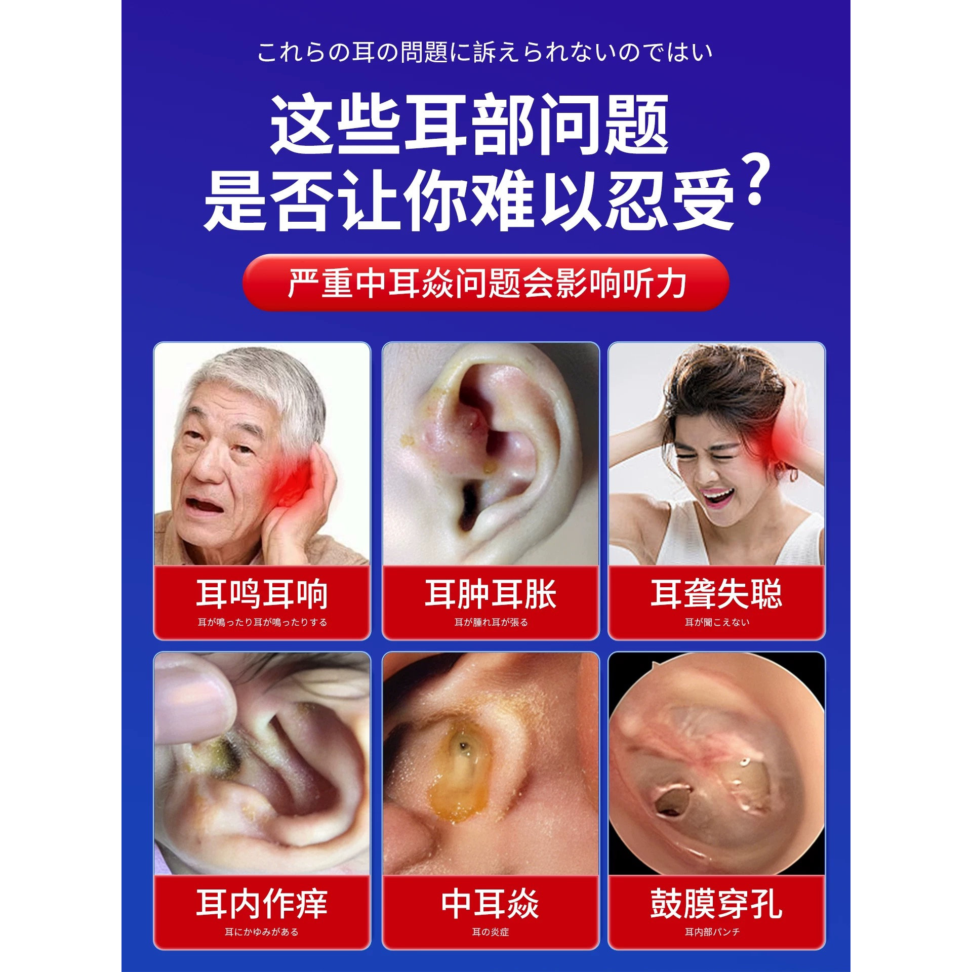 岩井昃弘制药神经性耳鸣滴耳液耳康耳朵止痒成人专用清洁软化耳屎 - 图2