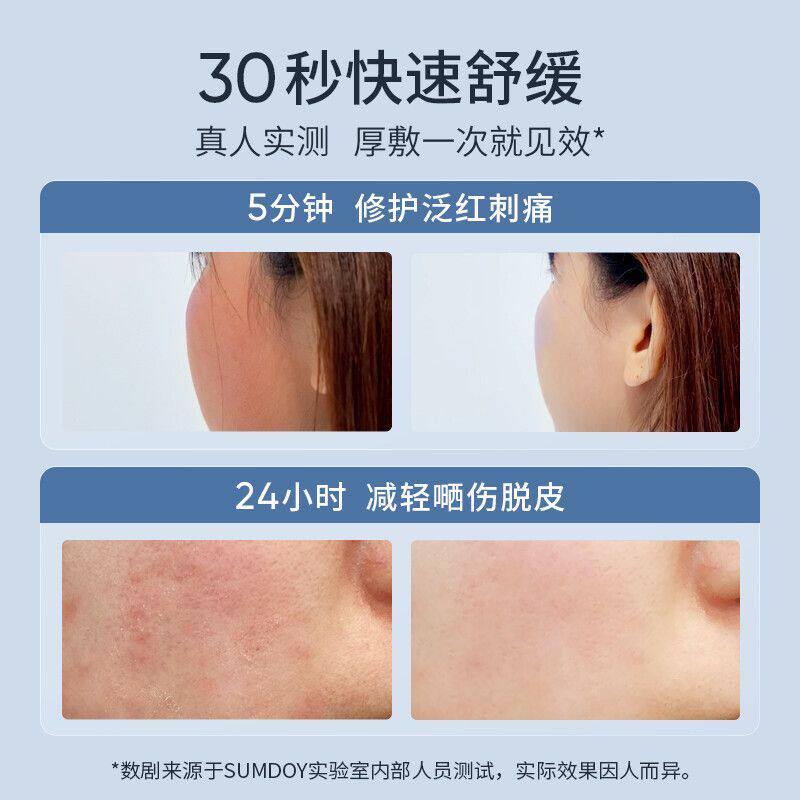 SUMDOY日本进口晒后修复凝胶全身体皮肤芦荟胶舒缓霜脸部晒伤修护