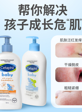 Cetaphil Daily Baby Lotion with Calendula, Hypoallergenic