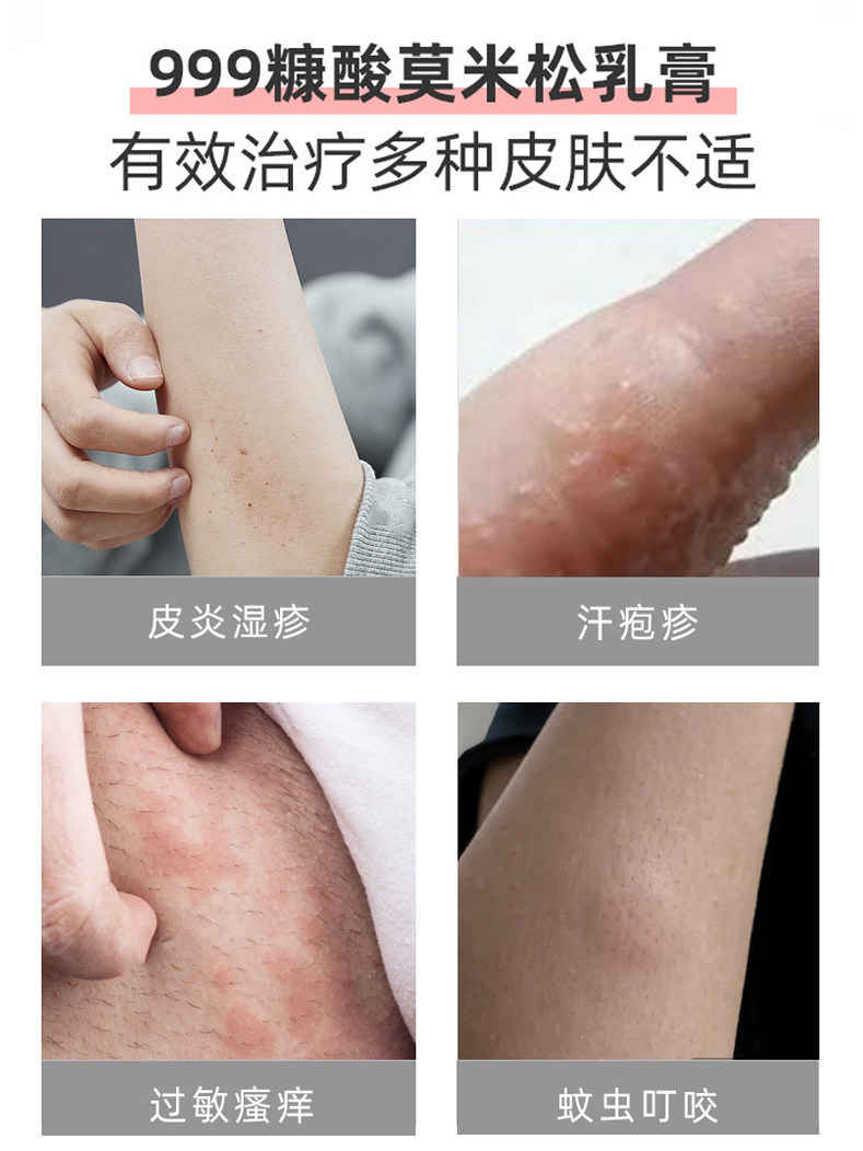 999三九糠酸莫米松乳膏10g软膏 999抗菌消炎