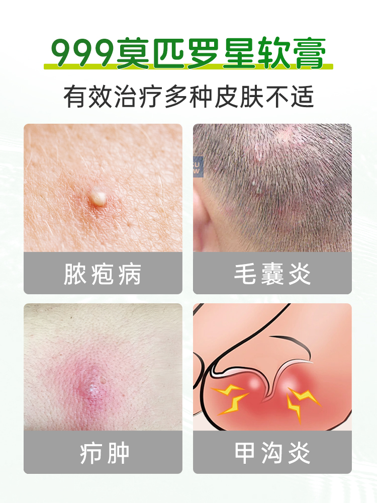 莫匹罗星软膏正品头皮毛囊炎洗发水脂溢性皮炎去屑止痒抑菌专用药 - 图0