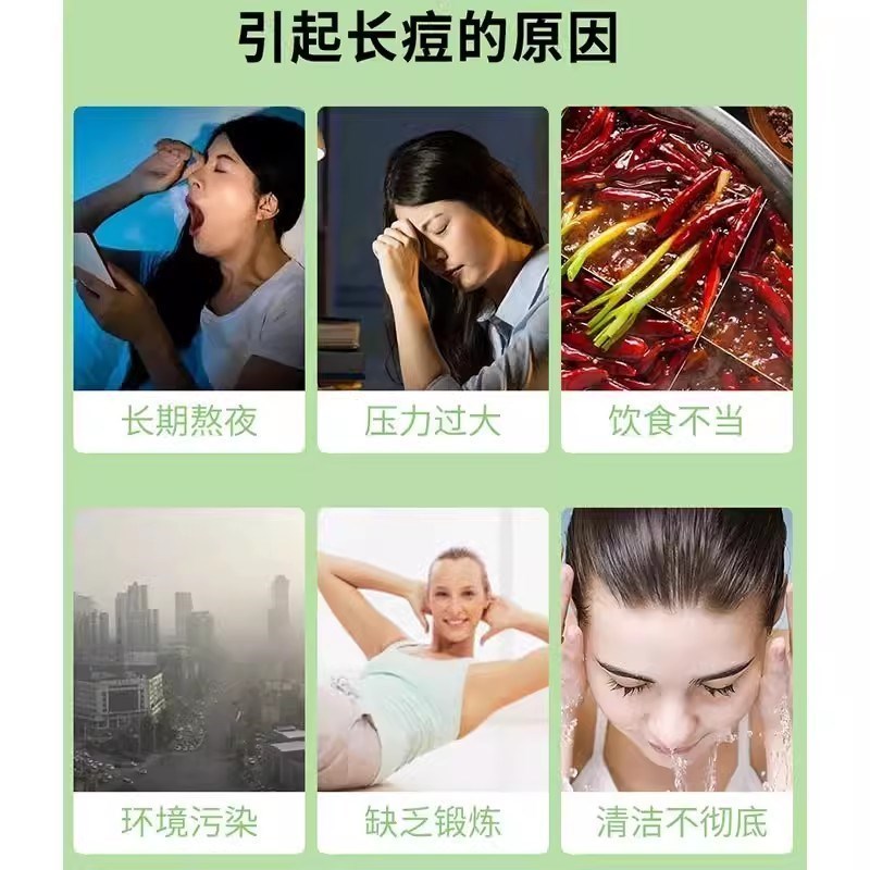 香港中西大药房祛痘膏青少年青春痘痘印痘坑粉刺闭口药房正品