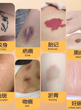 黄褐斑专用遮瑕膏粉遮盖斑点神器强力遮瑕持久不脱妆提亮肤色暗沉