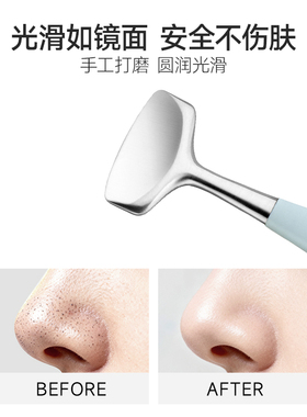 双立人双头黑头铲清洁粉刺毛孔