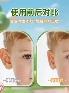 【婴儿耳朵矫正器】招风耳定型贴
